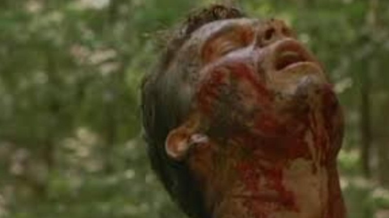 Bloody faced man in Bik Party Massacre